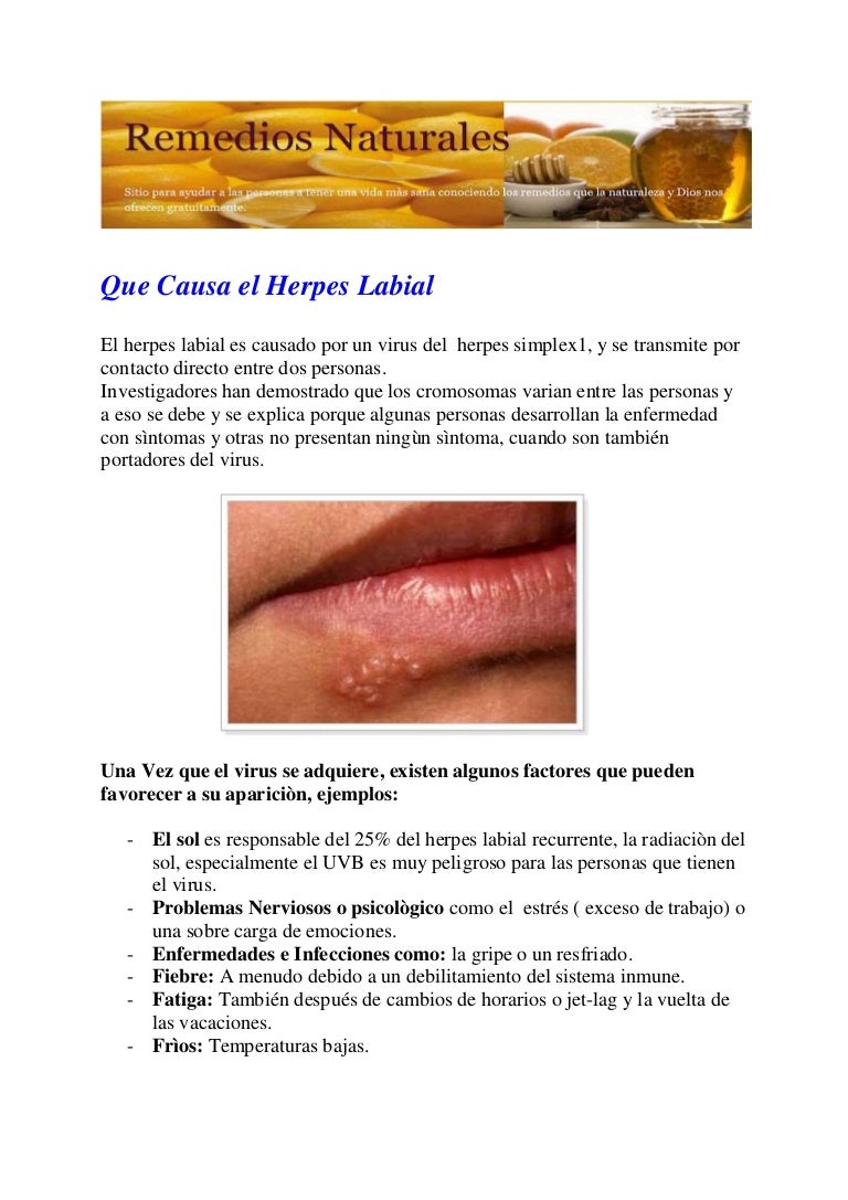 Que es el herpes como se transmite